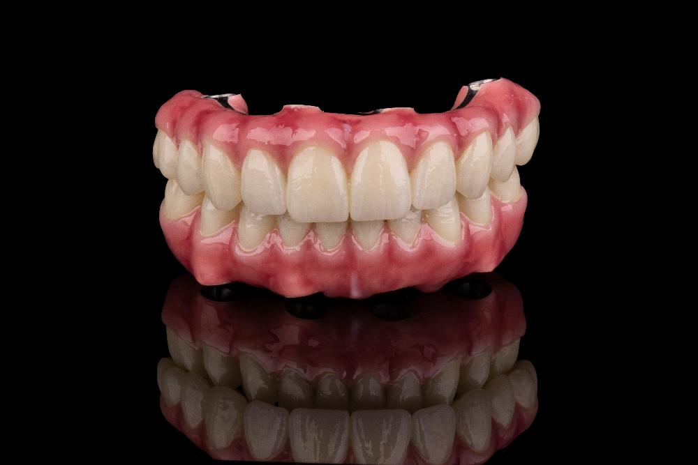 Full Dentures in Fayetteville, AR