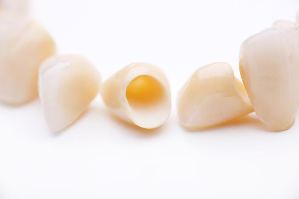 Image of dental crowns
