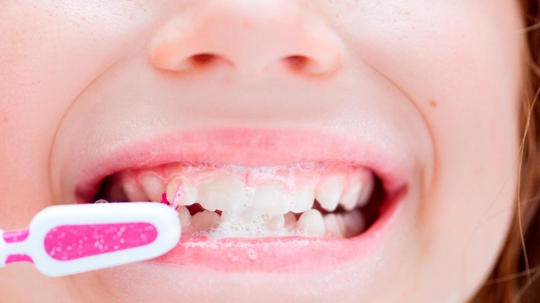 Northwest Arkansas Family Dental Blog Food and Drinks That Can Stain