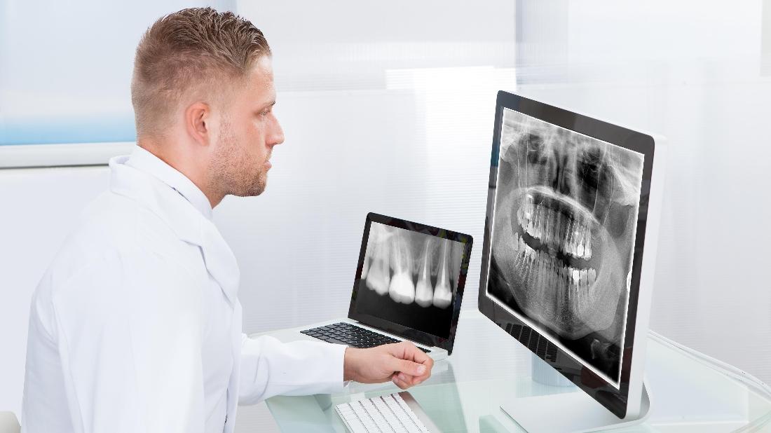 Dental XRays and Radiation Dentist Fayetteville AR