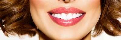 Teeth whitening in Fayetteville, AR