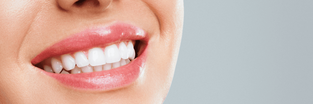 myobrace results fayetville