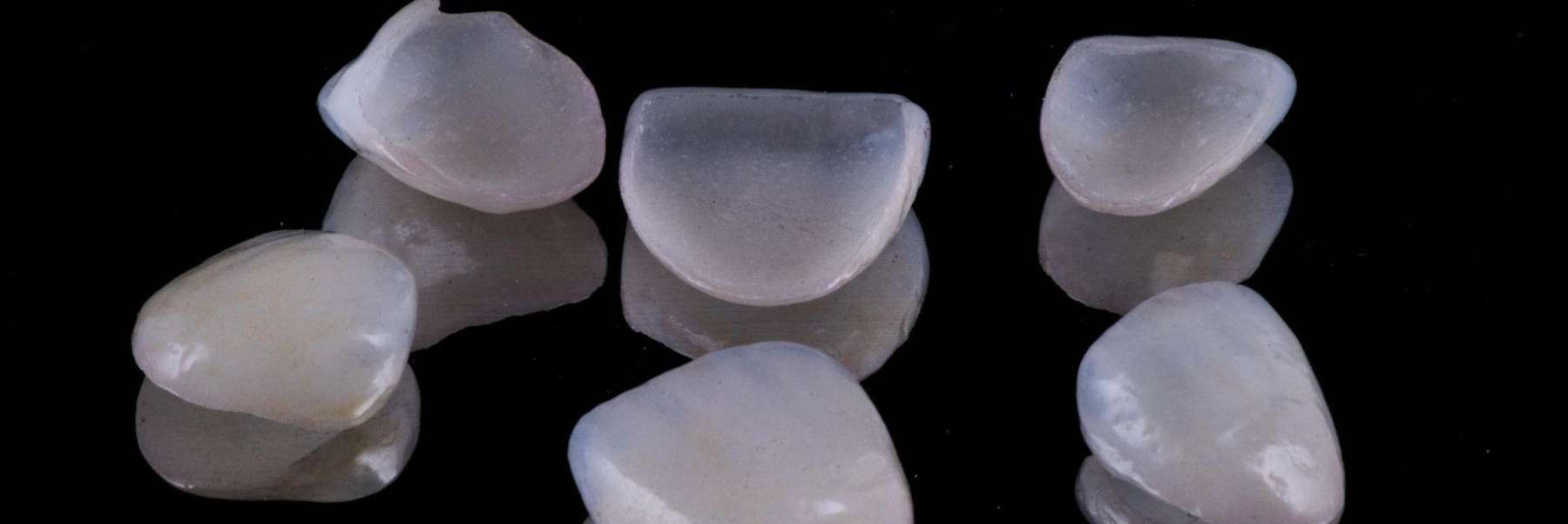 An image of Dental Veneers in Fayetteville